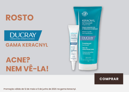 Acne? Nem vê-la!
