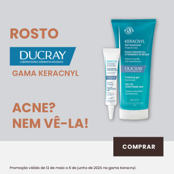 Acne? Nem vê-la!